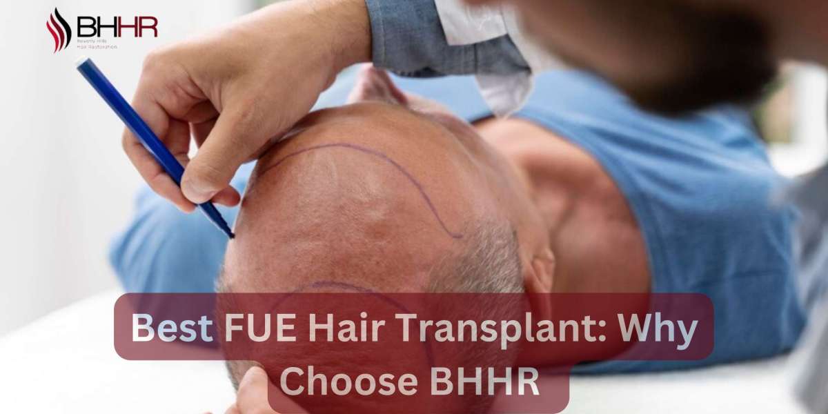 Best FUE Hair Transplant: Why Choose BHHR