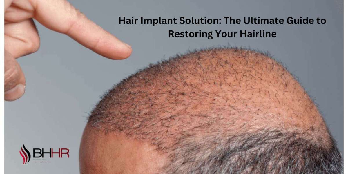 Hair Implant Solution: The Ultimate Guide to Restoring Your Hairline