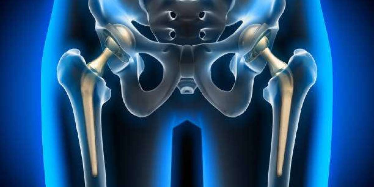 Advanced Total Hip Replacement Surgery at Gadge Hospital in Nagpur