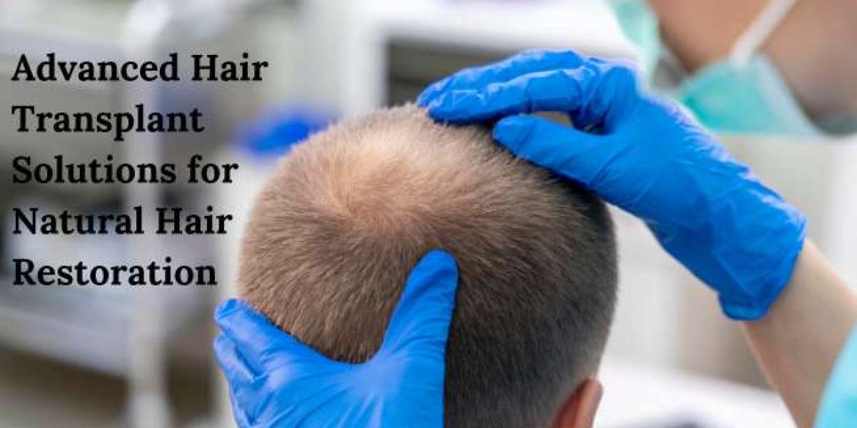 Advanced Hair Transplant Solutions for Natural Hair Restoration